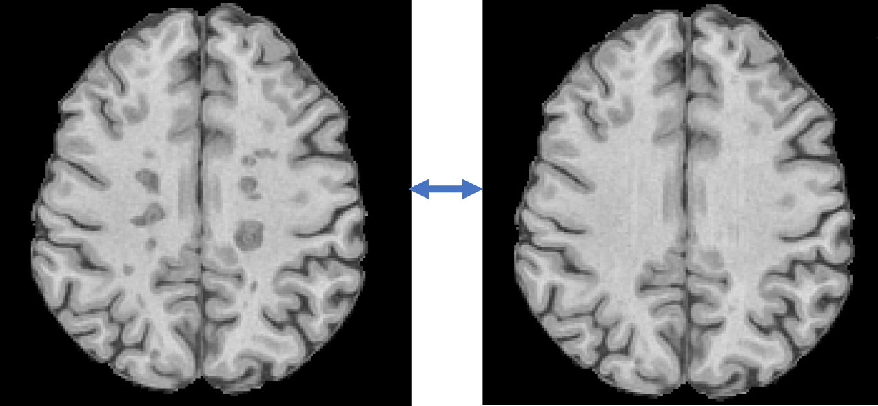 Neuroimaging AI | SNAC